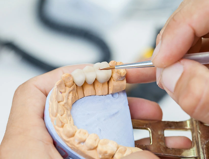 Preparing Dental bridge in lab