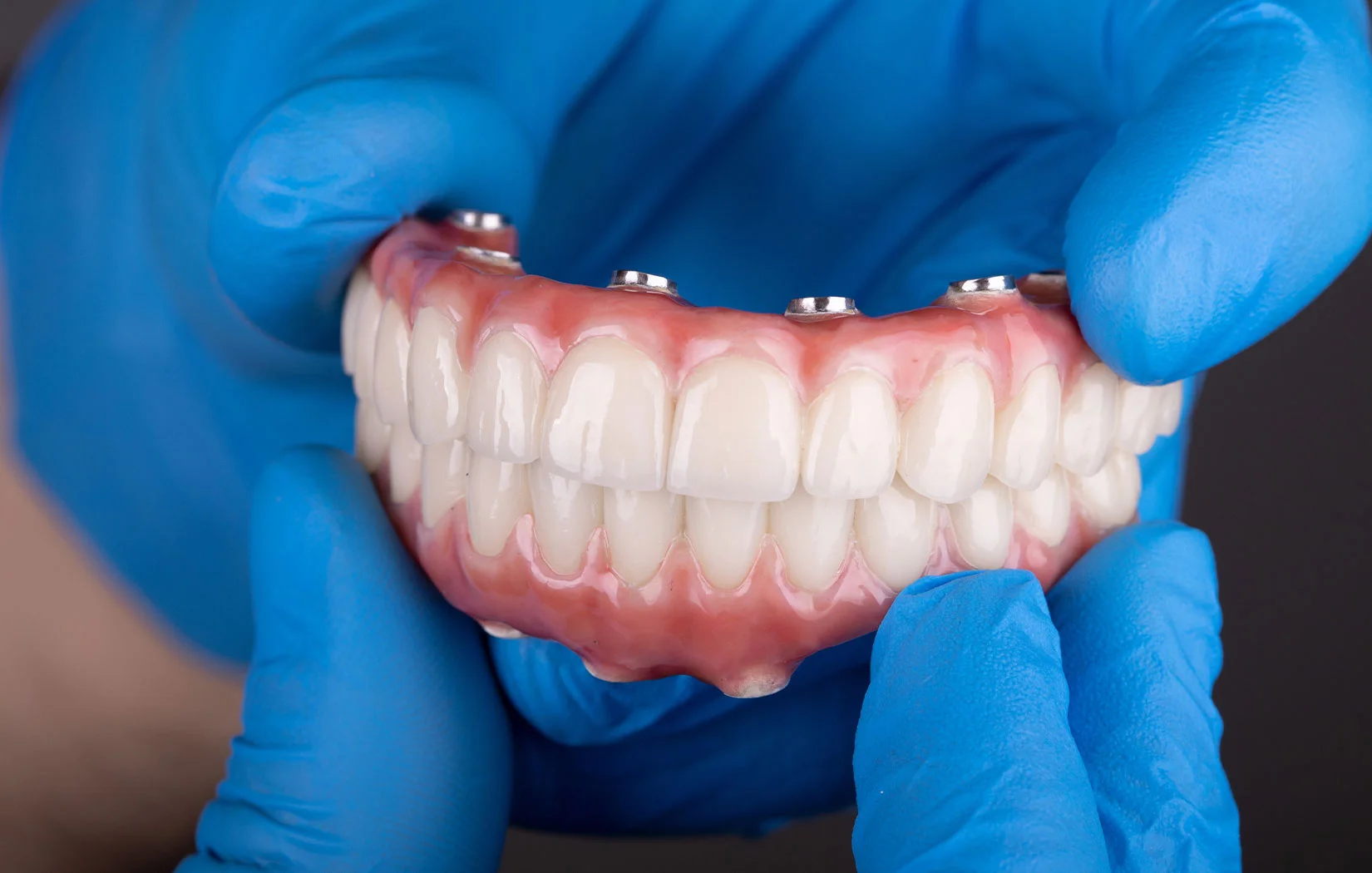 Dentist holding all-on 4 implants