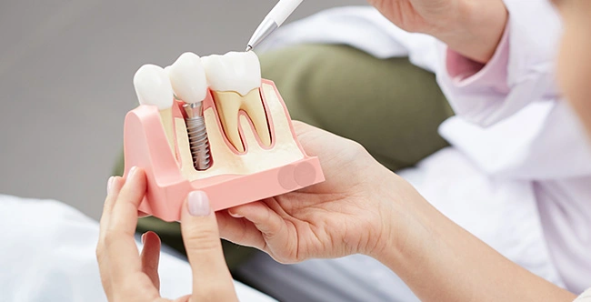 Dentist explaining dental implants to patient in Cameron Park , CA