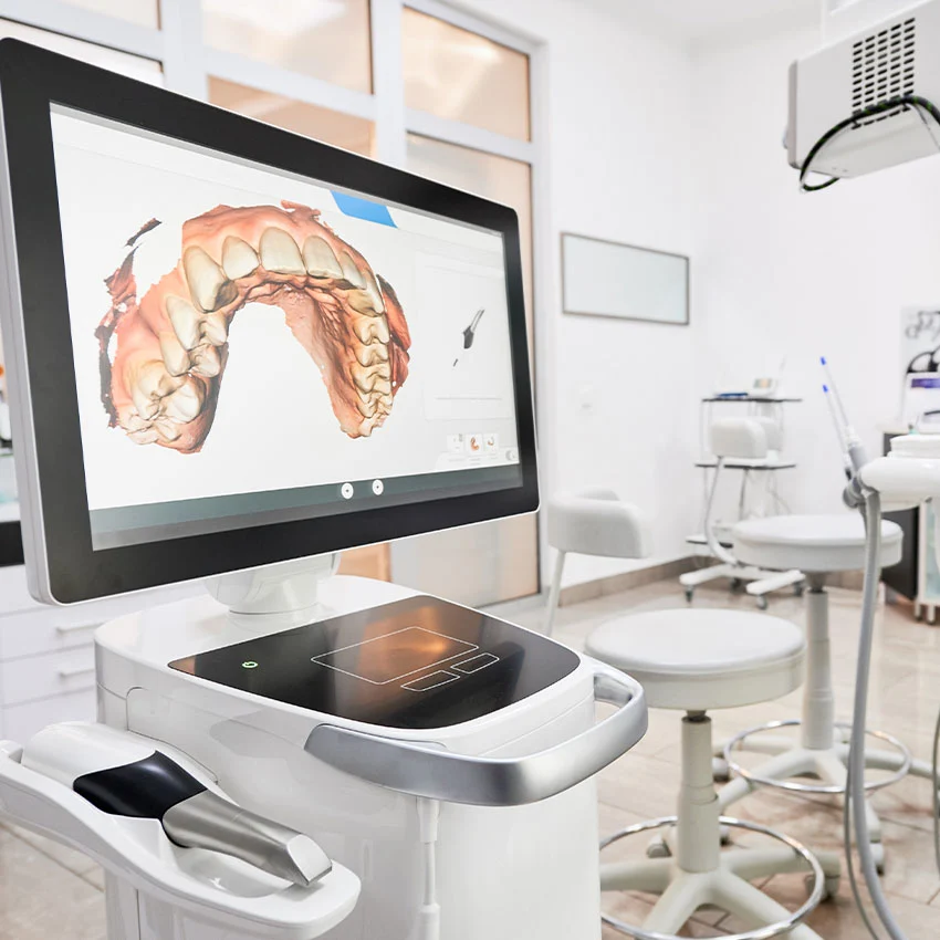 dental intraoral scanner with teeth on display in Cameron Park, CA