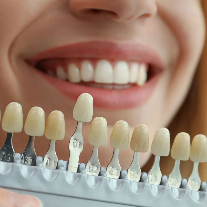 Dentist matching patients crown teeth color