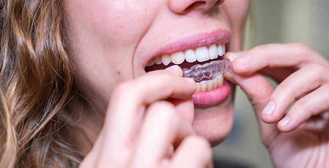 Patient trying Invisalign in Cameron Park, CA