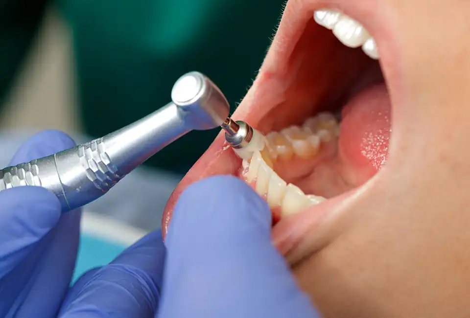 Patient getting professional teeth cleaning in Cameron Park, CA